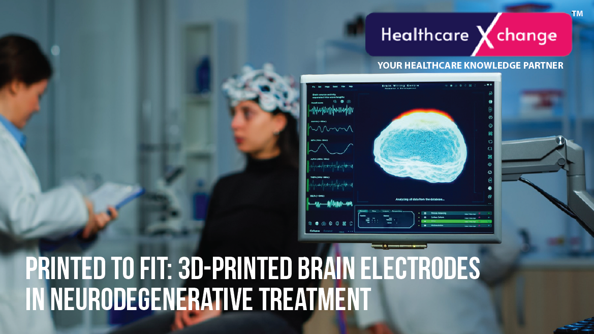 Printed to Fit: 3D-Printed Brain Electrodes in Neurodegenerative Treatment