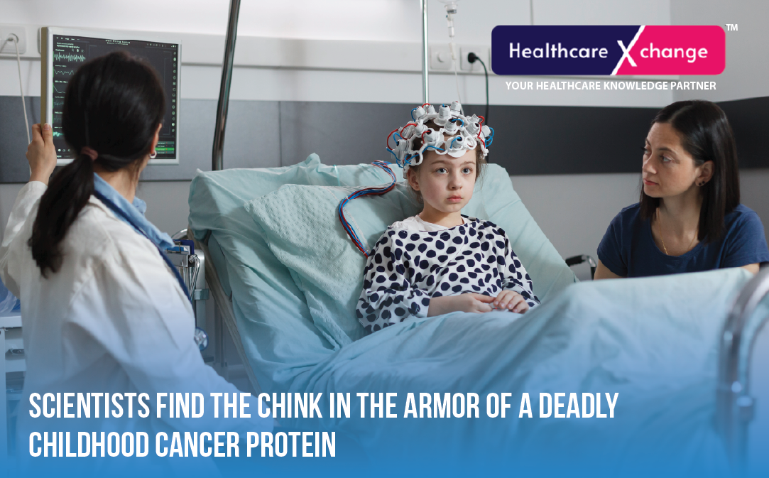 Scientists Find the Chink in the Armor of a Deadly Childhood Cancer Protein